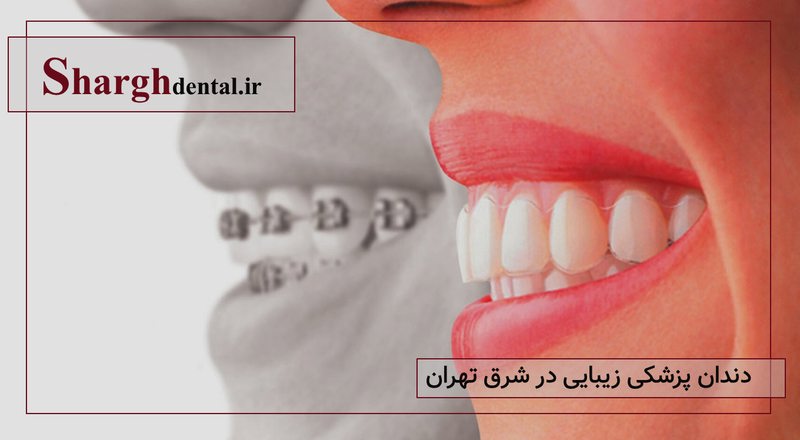 دندانپزشکی زیبایی در شرق تهران