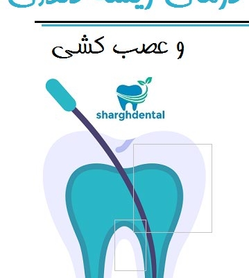 درمان ریشه دندان و عصب کشی