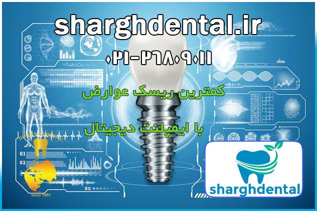معایب ایمپلنت دیجیتال دندان