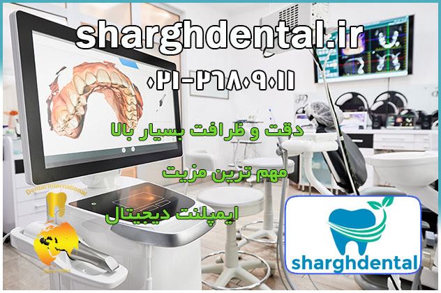 مزایای مهم انجام ایمپلنت دیجیتال