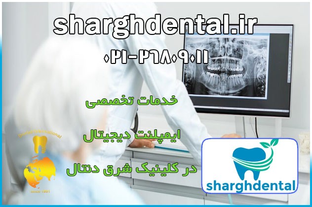 مدت درمان و طول عمر ایمپلنت دیجیتال در کلینیک تهرانپارس