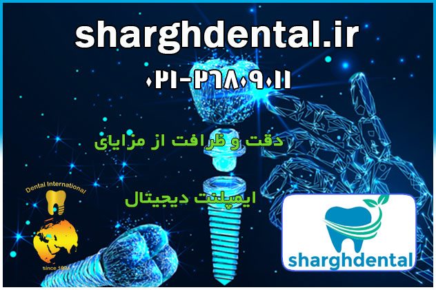 مزایا و مراحل ایمپلنت دیجیتال در تهرانپارس