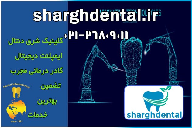 مفهوم ایمپلنت بدون درد چیست